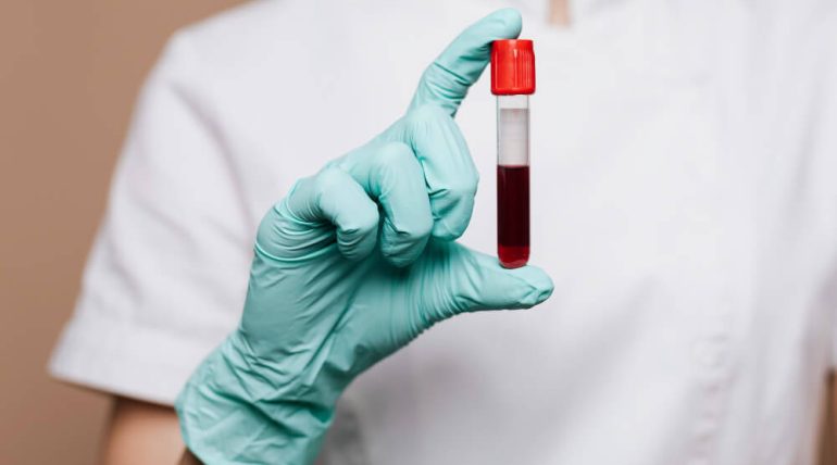 Reações Transfusionais: Tipos, Diagnóstico e Conduta | Guia Completo para Profissionais de Saúde