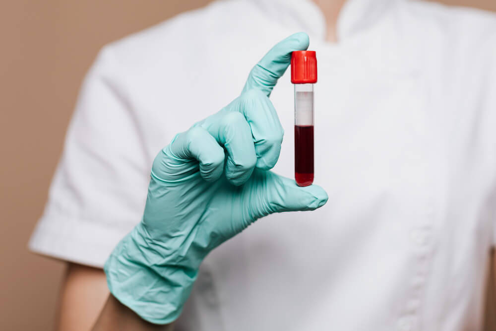 Reações Transfusionais: Tipos, Diagnóstico e Conduta